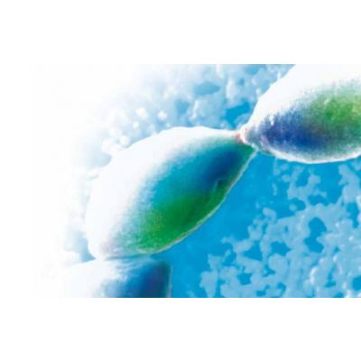LIAISON ® XL Toxo IgG Avidity