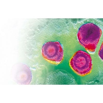 LIAISON ® CMV IgG II