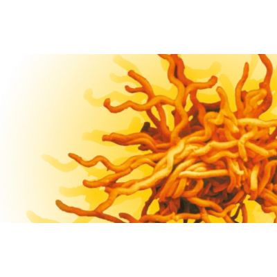 LIAISON ® Borrelia IgG