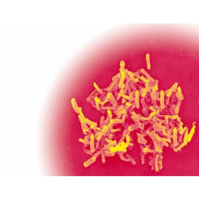 DiaSorin LIAISON ® C. difficile Toxinas A&B